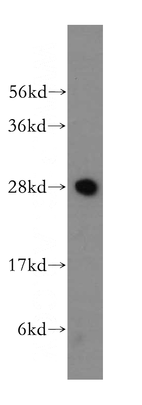 mouse testis tissue were subjected to SDS PAGE followed by western blot with Catalog No:111581(IAH1 antibody) at dilution of 1:500