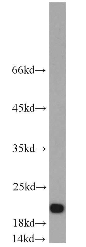 HepG2 cells were subjected to SDS PAGE followed by western blot with Catalog No:109936(DIABLO antibody) at dilution of 1:1000