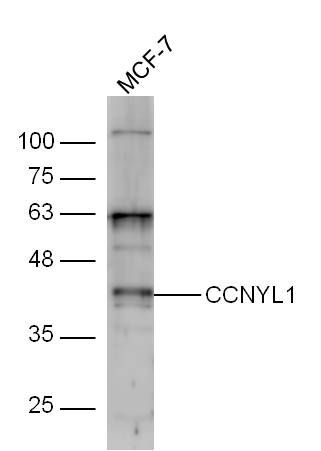 Fig1: Sample:; MCF-7 Cell (Human) Lysate at 30 ug; Primary: Anti-CCNYL1 at 1/300 dilution; Secondary: IRDye800CW Goat Anti-Rabbit IgG at 1/20000 dilution; Predicted band size: 41 kD; Observed band size: 41 kD