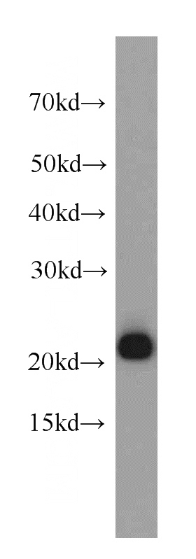 HeLa cells were subjected to SDS PAGE followed by western blot with Catalog No:114176(PRDX1 antibody) at dilution of 1:500