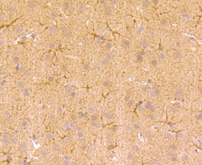 Fig8: Immunohistochemical analysis of paraffin-embedded rat brain tissue using anti-TGM6 antibody. Counter stained with hematoxylin.