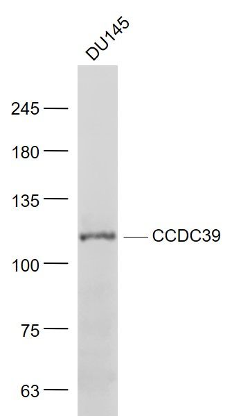 Fig1: Sample:; DU145(Human) Cell Lysate at 30 ug; Primary: Anti- CCDC39 at 1/1000 dilution; Secondary: IRDye800CW Goat Anti-Rabbit IgG at 1/20000 dilution; Predicted band size: 110 kD; Observed band size: 110 kD