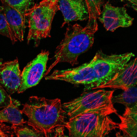 Immunofluorescence analysis of Hela cells using ABCG2 mouse mAb (green). Blue