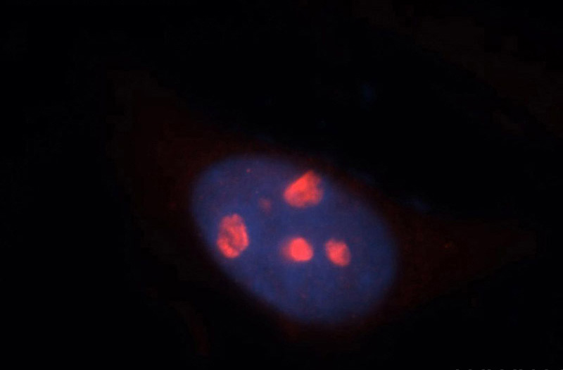 Immunofluorescent analysis of Hela cells, using NAT10 antibody Catalog No:112961 at 1:50 dilution and Rhodamine-labeled goat anti-rabbit IgG (red). Blue pseudocolor = DAPI (fluorescent DNA dye).