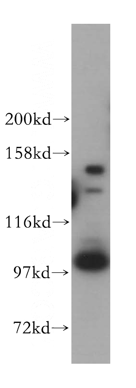HeLa cells were subjected to SDS PAGE followed by western blot with Catalog No:109525(CPSF2 antibody) at dilution of 1:800