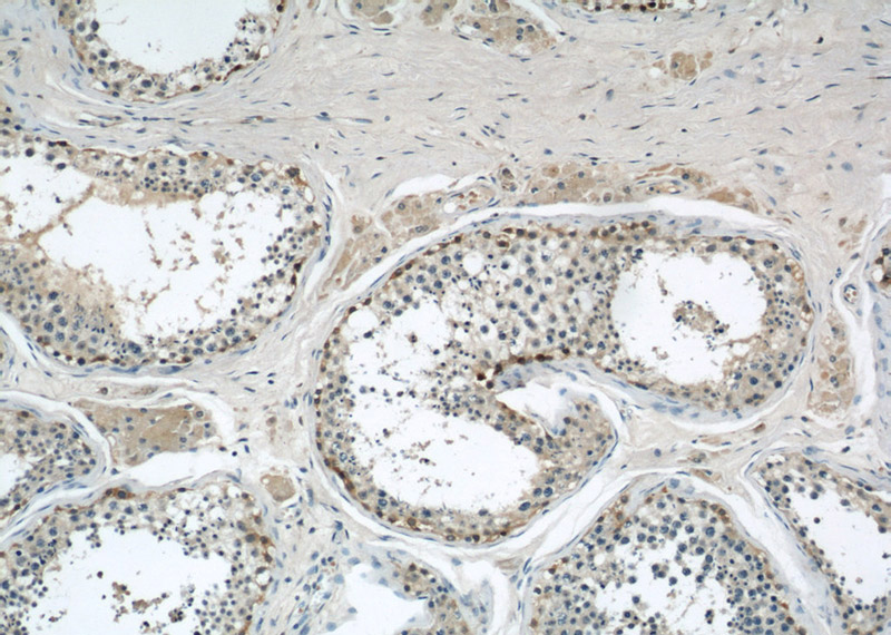 Immunohistochemical of paraffin-embedded human testis using Catalog No:107767(ADAM5P antibody) at dilution of 1:50 (under 10x lens)