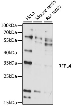 Western blot - RFPL4 Polyclonal Antibody 