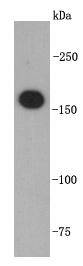 Fig1: Western blot analysis on Jurkat cell lysates using anti-TOP2A rabbit polyclonal antibodies.