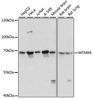 Western blot - MTMR9 Polyclonal Antibody 