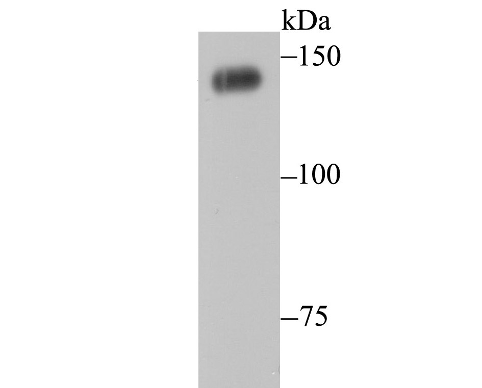 Fig1: Western blot analysis of PFAS on Hela cell lysate using anti-PFAS antibody at 1/1,000 dilution.