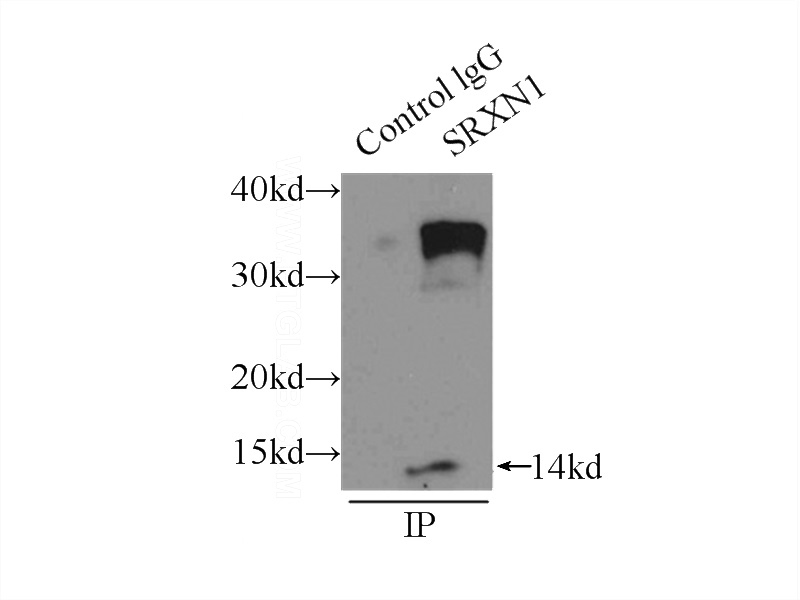IP Result of anti-SRX1 (IP:Catalog No:115602, 3ug; Detection:Catalog No:115602 1:400) with A549 cells lysate 3300ug.