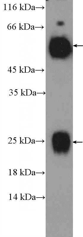 human plasma tissue were subjected to SDS PAGE followed by western blot with Catalog No:111721(Human-IgG Antibody) at dilution of 1:5000