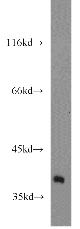 Jurkat cells were subjected to SDS PAGE followed by western blot with Catalog No:110608(FDPS antibody) at dilution of 1:1500