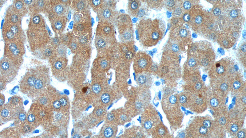 Immunohistochemistry of paraffin-embedded human liver tissue slide using Catalog No:108718(C3 Antibody) at dilution of 1:100 (under 40x lens).
