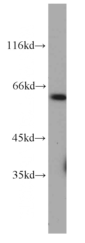 K-562 cells were subjected to SDS PAGE followed by western blot with Catalog No:107187(CXCR4 antibody) at dilution of 1:1000
