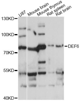 Western blot - DEF6 Polyclonal Antibody 