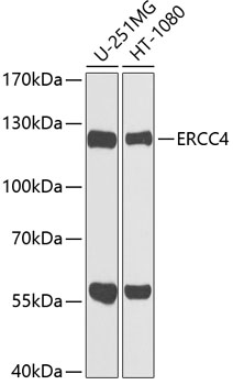 Western blot - ERCC4 Polyclonal Antibody 