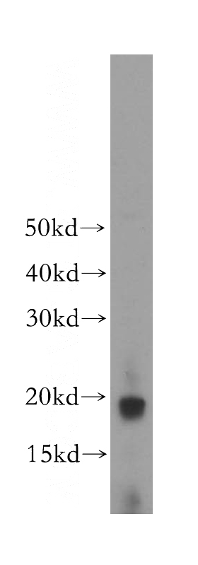 human heart tissue were subjected to SDS PAGE followed by western blot with Catalog No:109468(COQ10A antibody) at dilution of 1:1000
