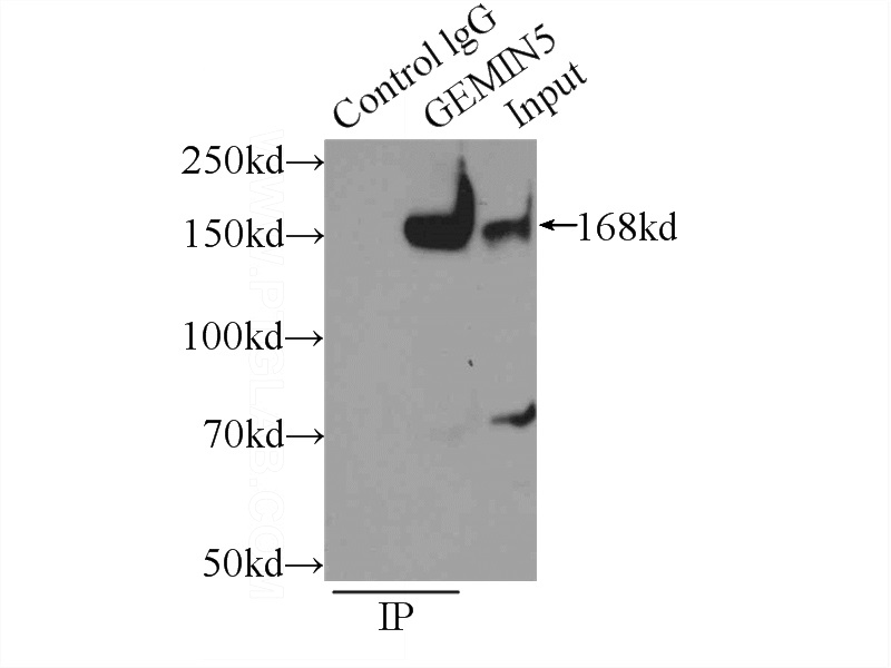 IP Result of anti-GEMIN5 (IP:Catalog No:110939, 5ug; Detection:Catalog No:110939 1:1000) with HeLa cells lysate 220ug.