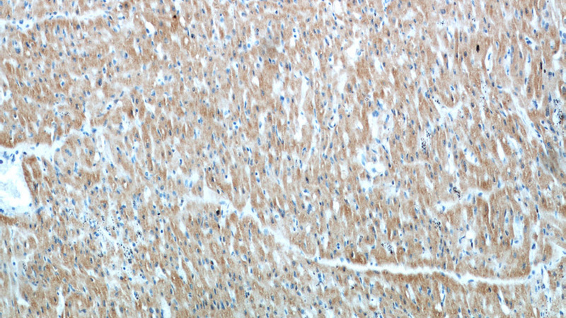 Immunohistochemical of paraffin-embedded human heart using Catalog No:116667(UBXN4 antibody) at dilution of 1:100 (under 10x lens)