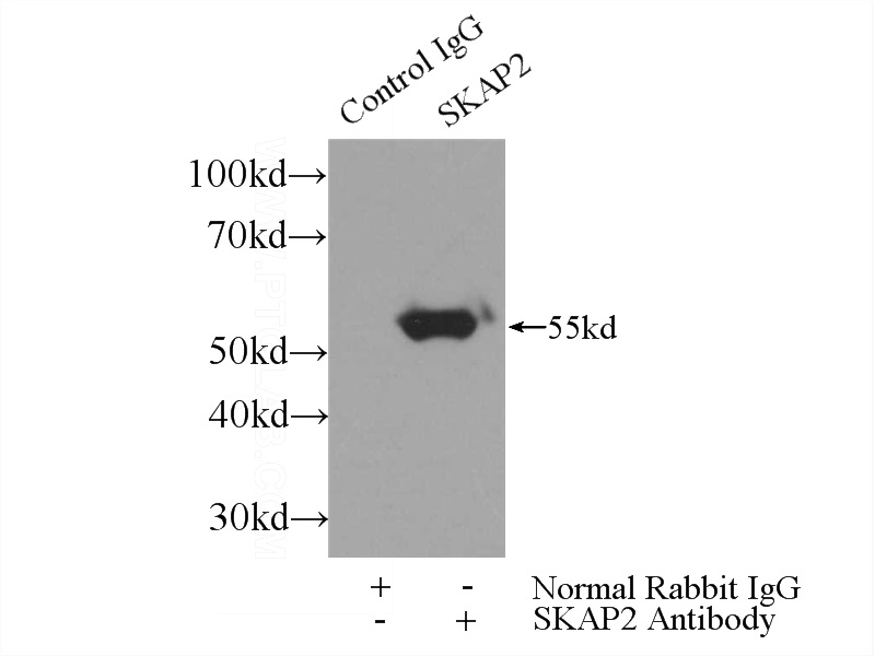 IP Result of anti-SKAP2 (IP:Catalog No:115253, 3ug; Detection:Catalog No:115253 1:700) with mouse liver tissue lysate 4000ug.