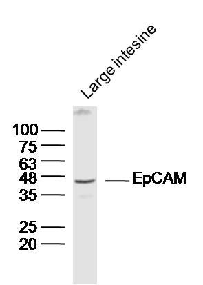 Fig1: Sample: large intestine(mouse) lysate at 30ug; Primary: Anti-EpCAM (bs-8185R) at 1/300 dilution Secondary: IRDye800CW Goat Anti-Rabbit IgG at 1/20000 dilution Predicted band size: 36 kD Observed band size: 43kD