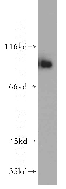 HeLa cells were subjected to SDS PAGE followed by western blot with Catalog No:112967(NBN antibody) at dilution of 1:800