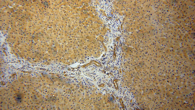 Immunohistochemical of paraffin-embedded human liver using Catalog No:107674(APEH antibody) at dilution of 1:100 (under 10x lens)
