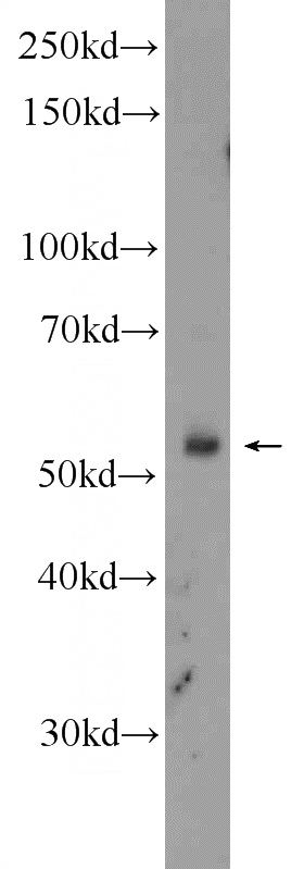 K-562 cells were subjected to SDS PAGE followed by western blot with Catalog No:110562(FBXW12 Antibody) at dilution of 1:300