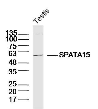 Fig3: Sample: Testis (Mouse) Lysate at 40 ug; Primary: Anti-SPATA15/SPATC1 at 1/300 dilution; Secondary: IRDye800CW Goat Anti-Rabbit IgG at 1/20000 dilution; Predicted band size: 62kD; Observed band size: 62kD