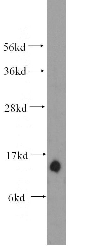human liver tissue were subjected to SDS PAGE followed by western blot with Catalog No:116172(TOMM22 antibody) at dilution of 1:500