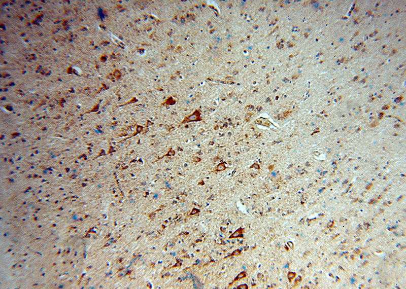 Immunohistochemical of paraffin-embedded human brain using Catalog No:109818(DAAM1 antibody) at dilution of 1:100 (under 10x lens)