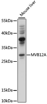 Western blot - MVB12A Polyclonal Antibody 