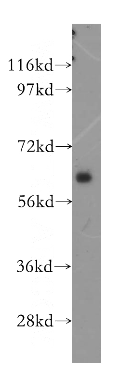 human brain tissue were subjected to SDS PAGE followed by western blot with Catalog No:113369(NUMB antibody) at dilution of 1:500