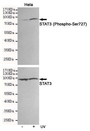 Western blot analysis of extracts from Hela cells, untreated or treated with UV, using STAT3 (Phospho-Ser727) Rabbit pAb (310091,1:500 diluted,upper) or p38 MAPK Rabbit pAb (310008,1:500 diluted,lower).