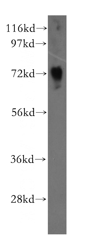 Jurkat cells were subjected to SDS PAGE followed by western blot with Catalog No:113362(NUDT6 antibody) at dilution of 1:500