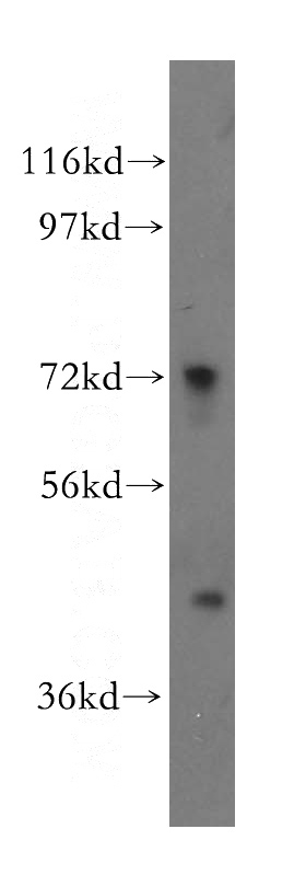 mouse thymus tissue were subjected to SDS PAGE followed by western blot with Catalog No:114602(RBM17 antibody) at dilution of 1:500