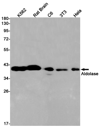 Western blot detection of Aldolase in K562,Rat Brain,C6,3T3,Hela cell lysates using Aldolase Rabbit pAb(1:1000 diluted).Predicted band size:39kDa.Observed band size:39kDa.
