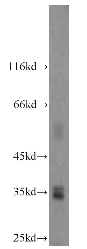 L02 cells were subjected to SDS PAGE followed by western blot with Catalog No:111544(HSD17B11 antibody) at dilution of 1:500