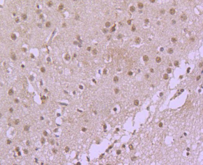 Fig5: Immunohistochemical analysis of paraffin-embedded rat brain tissue using anti-CDC40 antibody. Counter stained with hematoxylin.