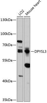Western blot - DPYSL3 Polyclonal Antibody 
