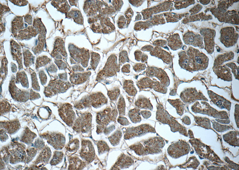 Immunohistochemistry of paraffin-embedded human heart tissue slide using Catalog No:114715(RIPK1-Specific Antibody) at dilution of 1:50 (under 40x lens)