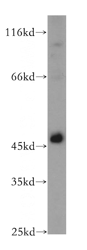 HeLa cells were subjected to SDS PAGE followed by western blot with Catalog No:116428(TSG101 antibody) at dilution of 1:500