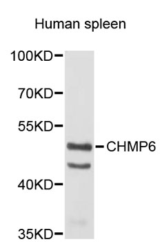 Western blot - CHMP6 Polyclonal Antibody 
