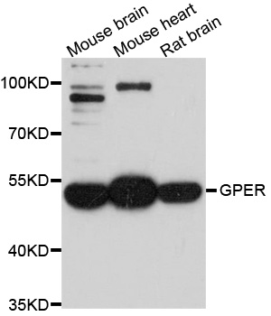 Western blot - GPER1 Polyclonal Antibody 