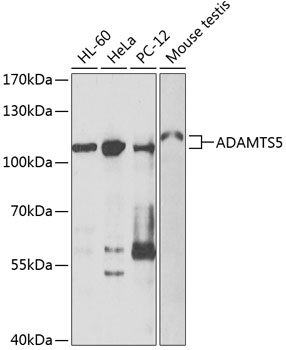 Western blot - ADAMTS5 Polyclonal Antibody 