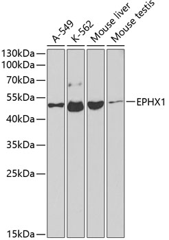 Western blot - EPHX1 Polyclonal Antibody 