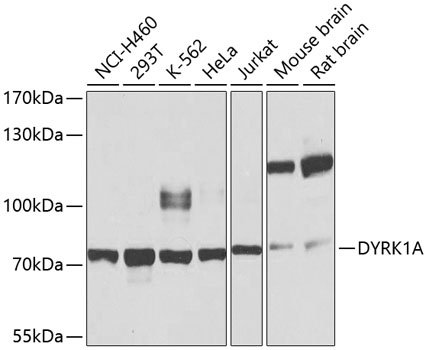Western blot - DYRK1A Polyclonal Antibody 