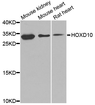 Western blot - HOXD10 Polyclonal Antibody 
