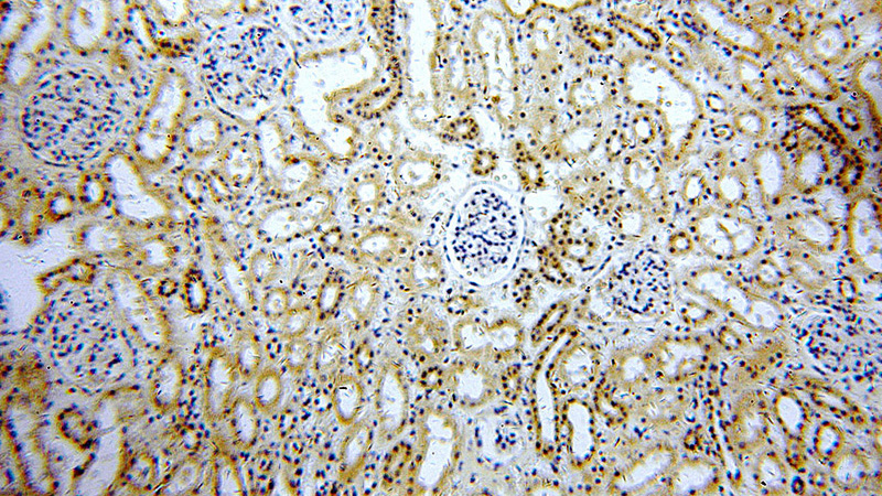 Immunohistochemical of paraffin-embedded human kidney using Catalog No:108738(C5orf44 antibody) at dilution of 1:50 (under 10x lens)